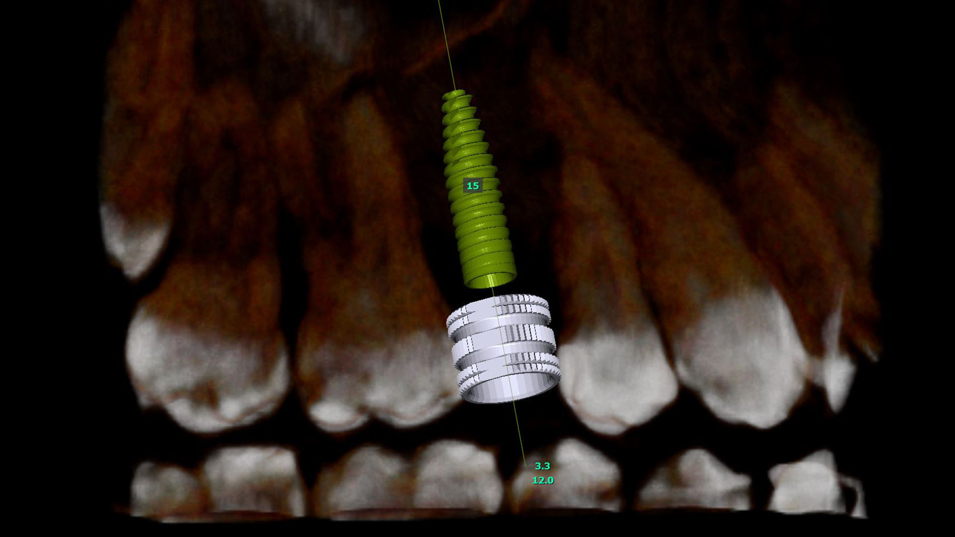 schoen-dentale-implantologie-2.jpg